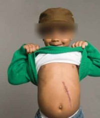 Dos niños se intercambian el hígado jugando a los médicos