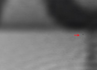 Examinan un banner con un microscopio en busca de la equis para cerrarlo