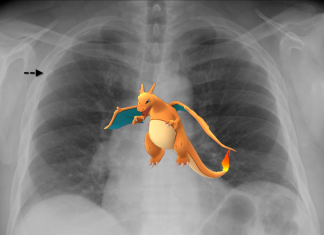 Operan a un paciente de urgencia porque el cirujano detectó un Pokémon en sus pulmones