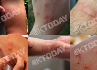 OKTODAY accede a las fotografías de las lesiones que sufrieron los policías por los incidentes provocados por los radicales el pasado domingo en Madrid